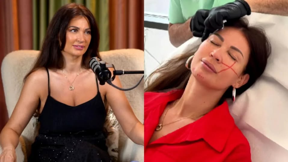 Nicoleta Luciu, noi ajustări estetice: „Îmi doream un efect de lifting discret”