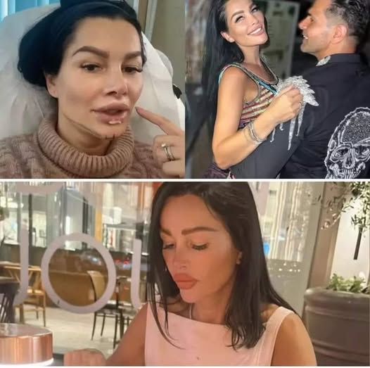 Brigitte Pastramă: peste 20 de intervenții estetice și un nou început la Dubai