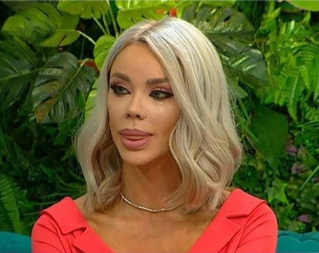 Bianca Drăgușanu, despre alegeri greșite în estetica facială: „Evitați acest pas, indiferent de promisiuni!”