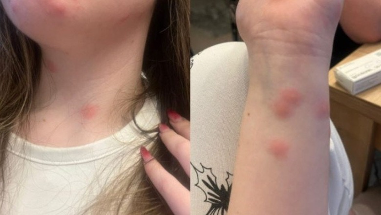 Caz revoltător în CFR! O tânără a ajuns direct la spital după o călătorie cu cușeta