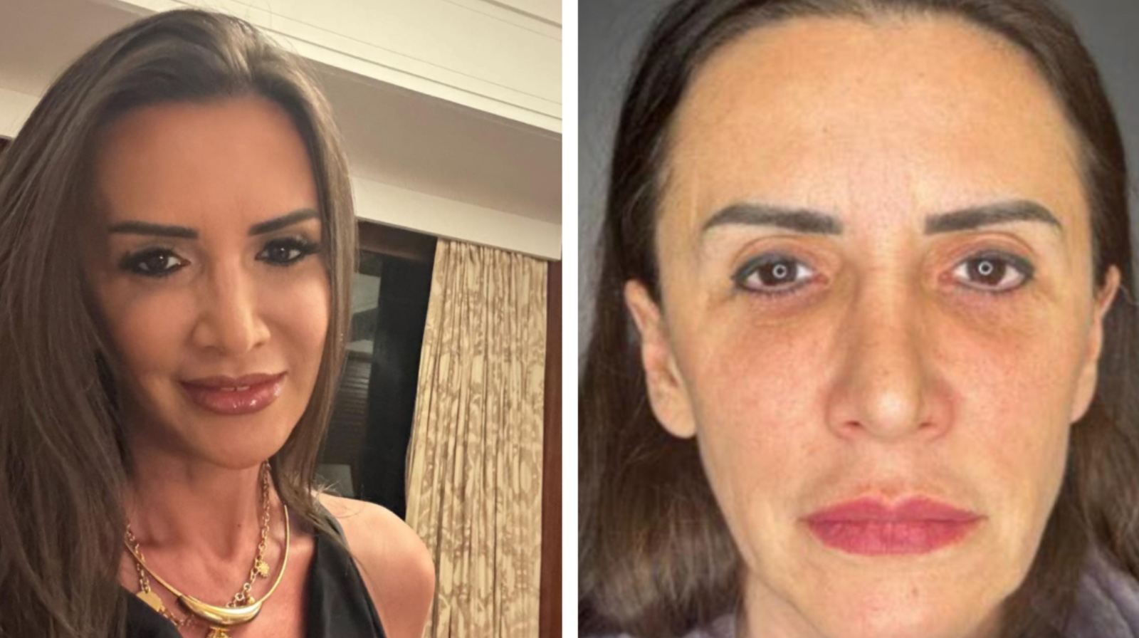 Mara Bănică, mesaj tranșant pentru criticii care i-au comentat liftingul facial: „Era mai bine să spun că m-am apucat de yoga?!”