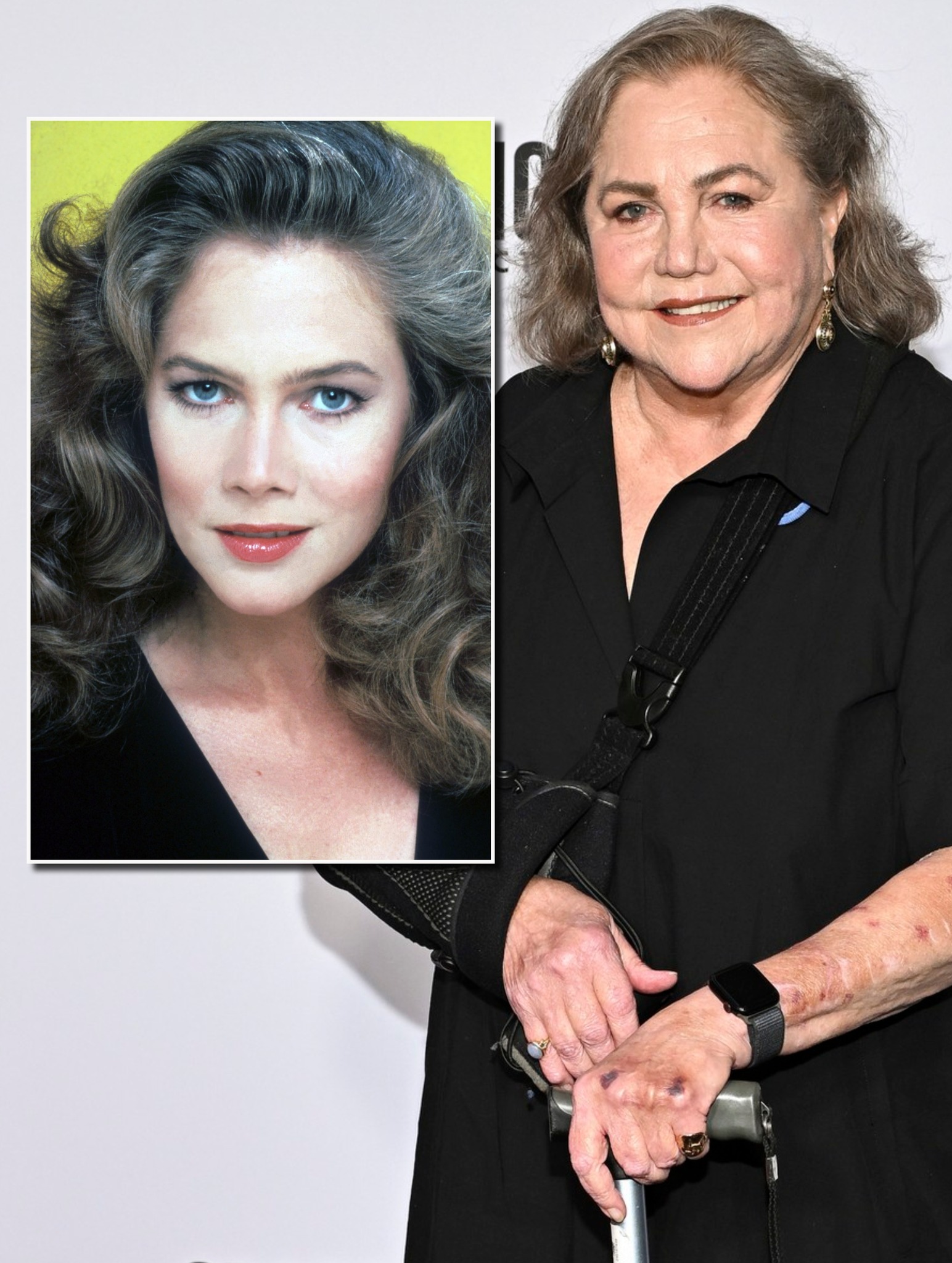 A fost zeița cinematografiei anilor ’80, o frumusețe care a scris istorie. Povestea impresionantă a unei femei care a înfruntat boala și a renăscut