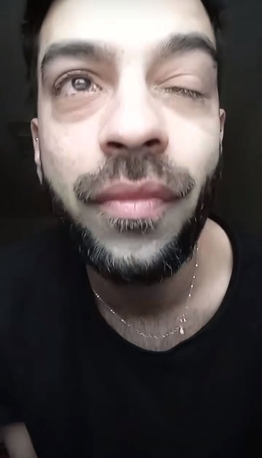 David Pușcaș, apariție care i-a îngrijorat pe fani! Tânărul s-a trezit cu o problemă la ochi și s-a speriat