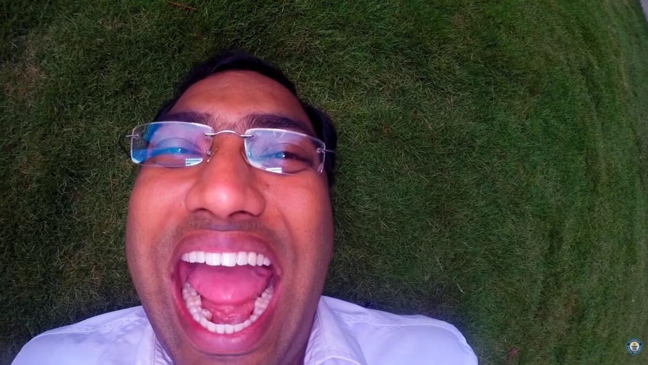 Zâmbet unic în lume! Bărbatul care i-a uimit pe medici cu cei 42 de dinți