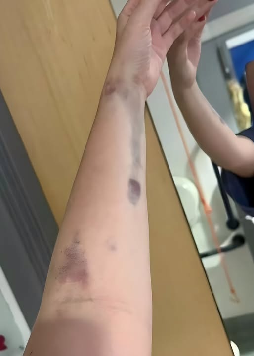 Tot mai multe cazuri de gripă în România! Medicii trag un semnal de alarmă: simptomul care apare încă din primele ore ale bolii